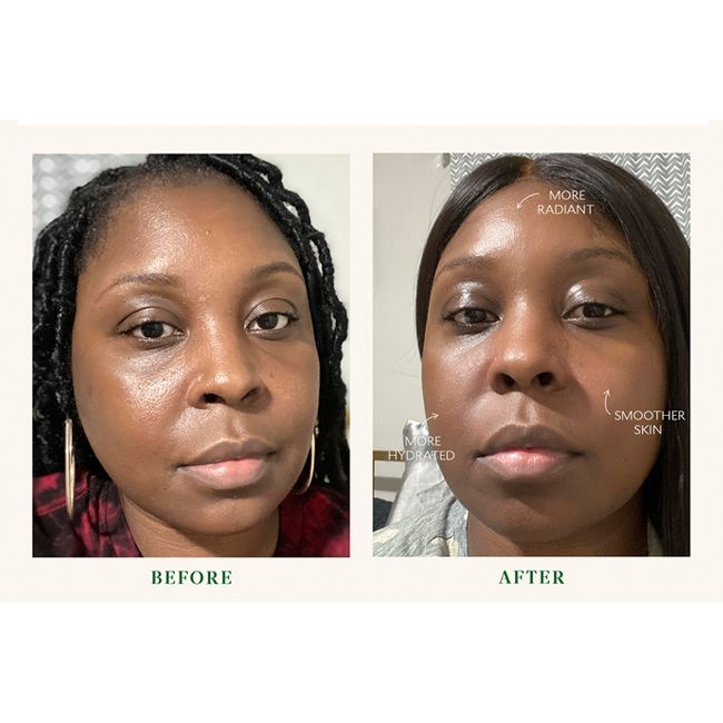 Crème contour des yeux Bio-Barrier Superkind Tata Harper Mannequin Lifestyle