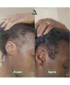 Pousse cheveux compléments alimentaires gummies In Haircaire application