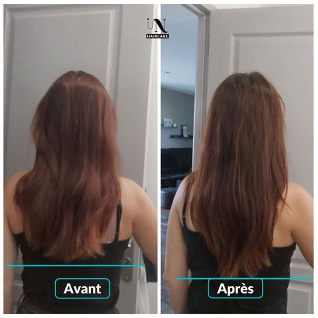 Pousse cheveux compléments alimentaires gummies In Haircaire model