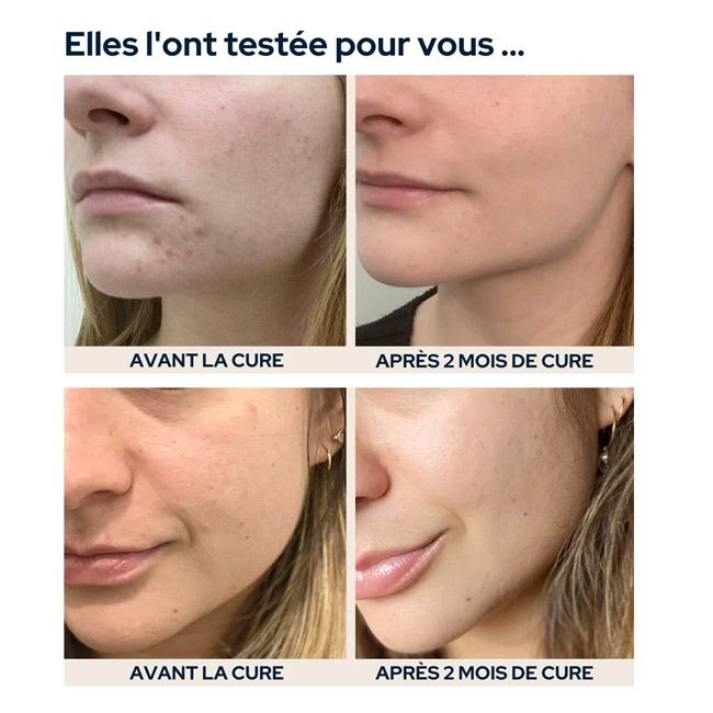 Complément alimentaire belle peau Epycure cosmetiques