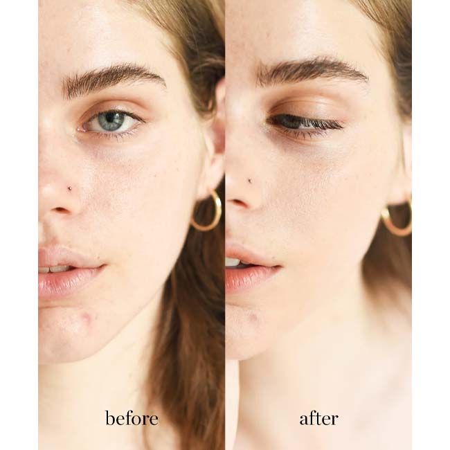 Ere Perez Rise Quinoa Water Foundation before after