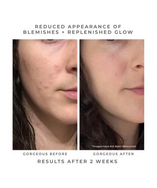 Oasis Deep Pore Gel Cleanser - 60 ml