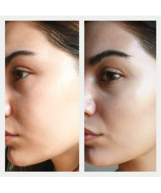 Resurfacing serum - 30 ml Resurfacing serum - 30 ml