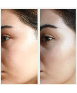 Resurfacing mask - 30 ml Resurfacing mask - 30 ml