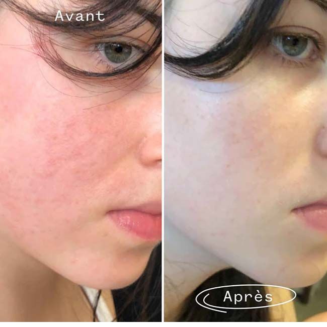 Pai Skincare's The Light Fantastic Organic Face Oil Results