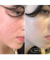 Pai Skincare's The Light Fantastic Organic Face Oil Results