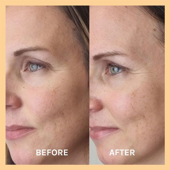 Evolve Beauty's Miracle AHA 3 Minute Mask resultat