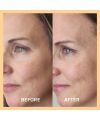 Masque Miracle Vitamin C Evolve Beauty application