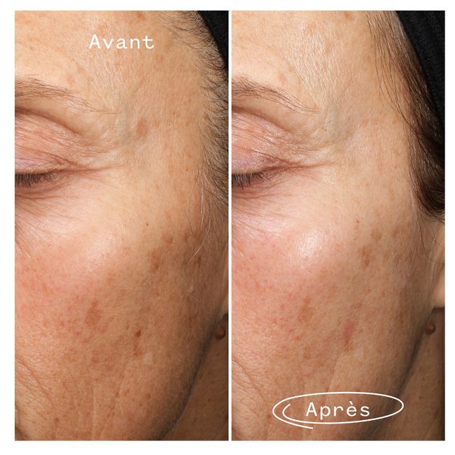 Sérum Anti-Taches brunes aux Algues Marines Fade Forward Pai Skincare  resultat