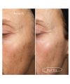 Sérum Anti-Taches brunes aux Algues Marines Fade Forward Pai Skincare  resultat