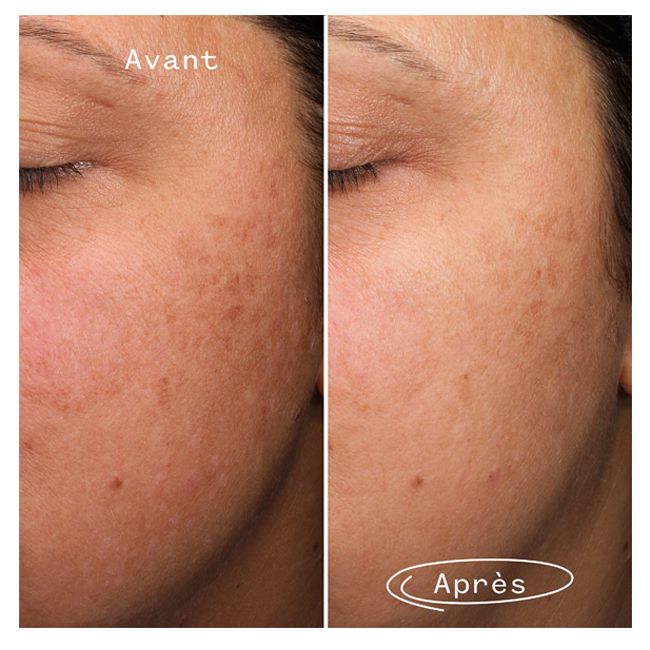 Sérum Anti-Taches brunes aux Algues Marines Fade Forward Pai Skincare mannequin