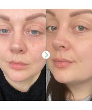 Huile au rosier sauvage Bioregenerate