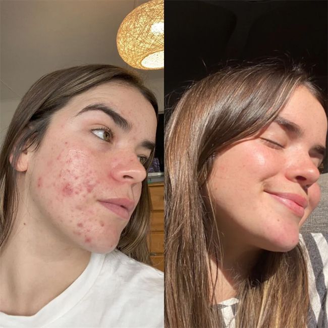Eco by Sonya's Miraculous Face Oil Results