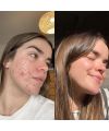 Eco by Sonya's Miraculous Face Oil Results