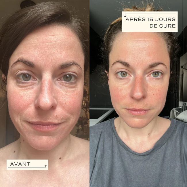 Circles Collagen Essential collagen supplement Results