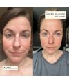 Circles Collagen Essential collagen supplement Results