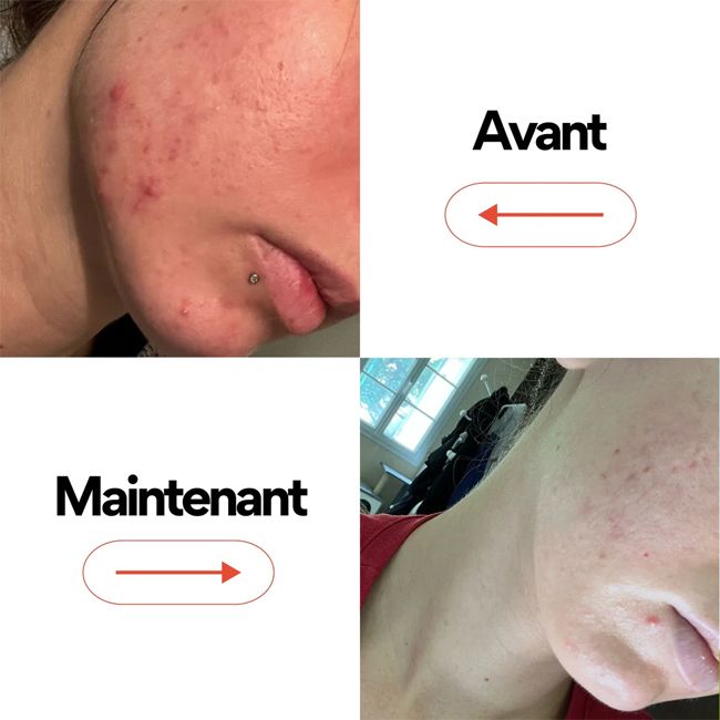 Skin & Out's CLEAN IN cleanser Natural food supplement Results