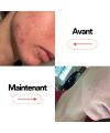 Skin & Out's CLEAN IN cleanser Natural food supplement Results
