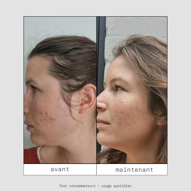 Crème hydratante naturelle FEED OUT Skin & Out Résultats