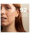 Soin anti-imperfections CLEAR OUT stop-boutons Skin & Out Cosmétique