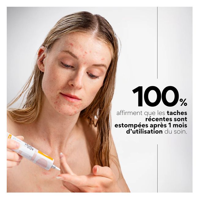 Soin anti-imperfections EVENT OUT anti-taches Skin & Out Cosmétique