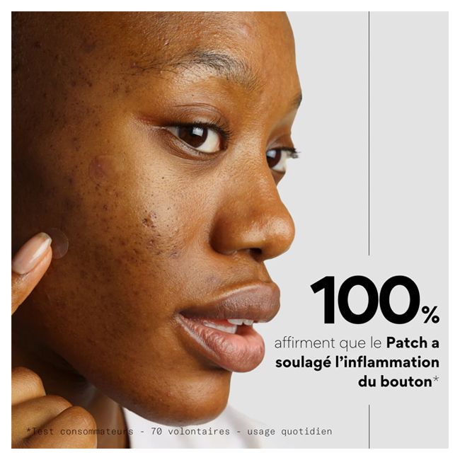 Skin & Out's CLEAR OUT Anti-blemish patch Model