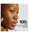 Skin & Out's CLEAR OUT Anti-blemish patch Model