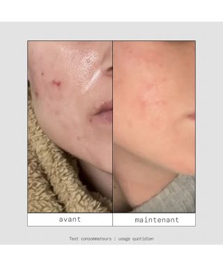 Mini routine spéciale boutons Minis Shtars