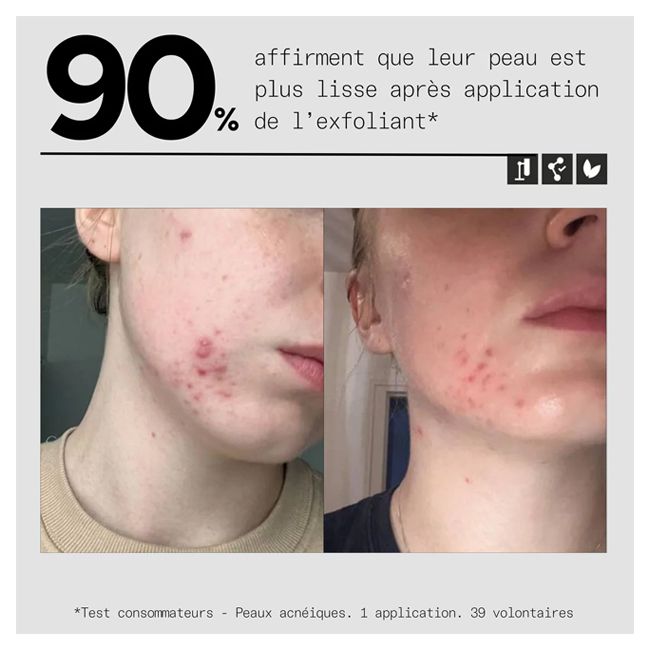 Masque visage bio exfoliant PEEL OUT Skin & Out Résultats