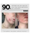 Masque visage bio exfoliant PEEL OUT Skin & Out Résultats