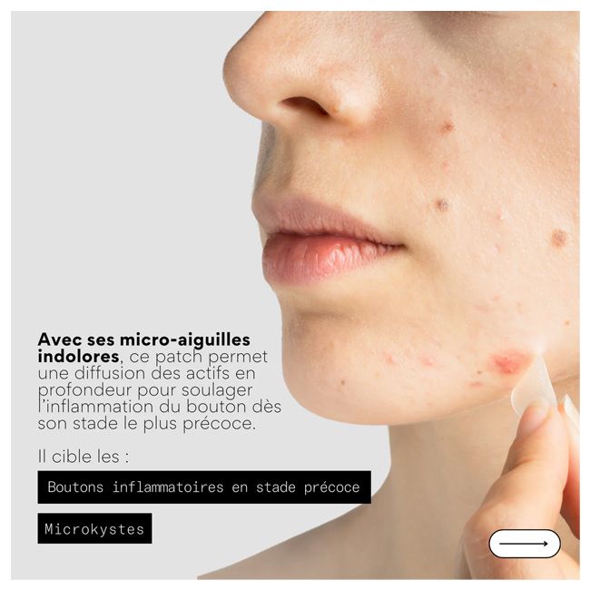 Patch anti-boutons micro aiguilles CLEAR OUT Skin & Out Bienfaits