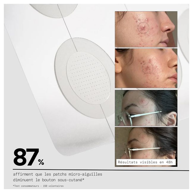Patch anti-boutons micro aiguilles CLEAR OUT Skin & Out Cosmétique