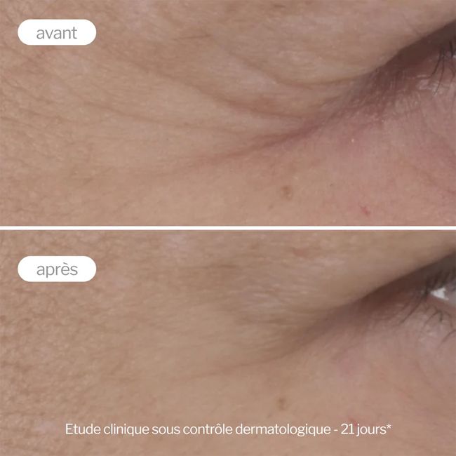 Contour des yeux naturel Anti- Age Expert Novexpert Résultats
