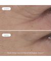 Contour des yeux naturel Anti- Age Expert Novexpert Résultats