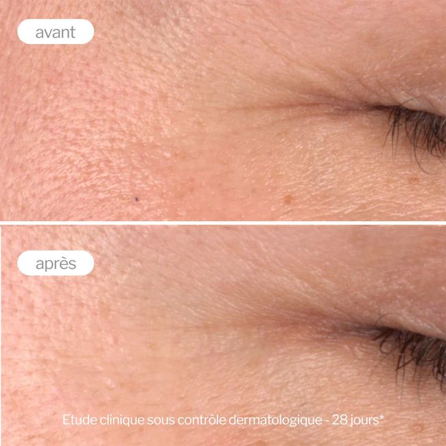 Sérum visage naturel Booster Pro- Collagène Novexpert Résultats