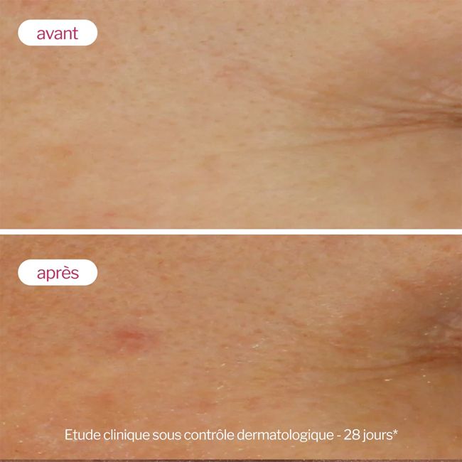 Sérum Booster à l'Acide Hyluronique Novexpert Résultats