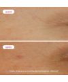 Novexpert's Hyaluronic Acid Booster Serum Results