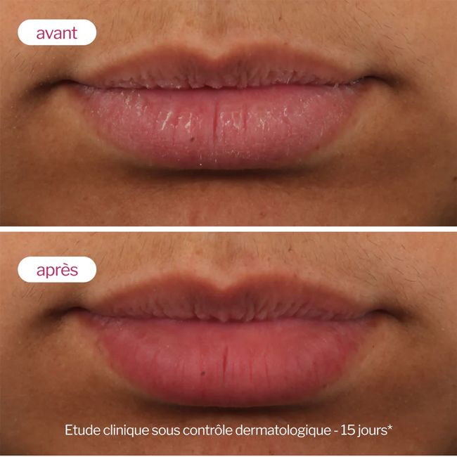 Baume à lèvres bio Lip'Up Novexpert Résultats