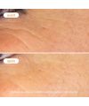 Sérum booster à la Vitamine C Novexpert Résultats