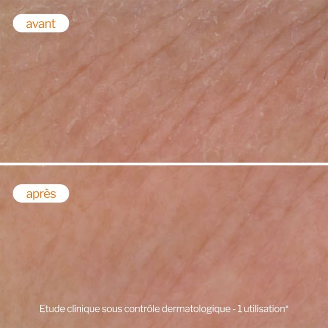 Mousse nettoyante Flash Eclat Novexpert Résultats