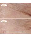 Crème Légère à la Vitamine C Novexpert Résultats