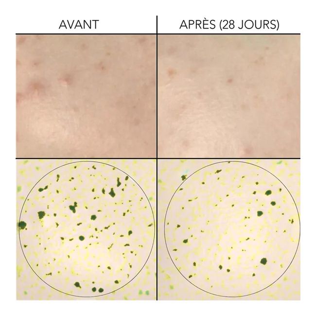 Skin Diligent's natural face Régulation Serum Before After
