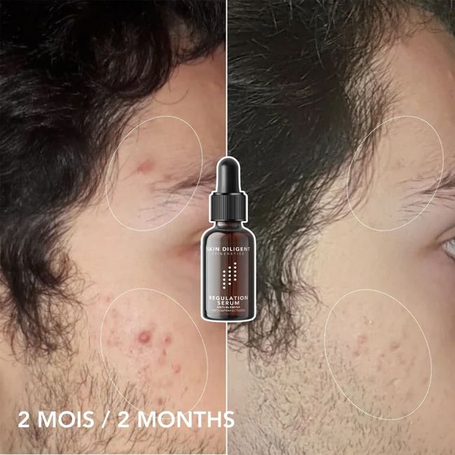 Skin Diligent's natural face Régulation Serum Results