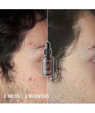 Regulation serum