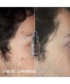 Skin Diligent's natural face Régulation Serum Results