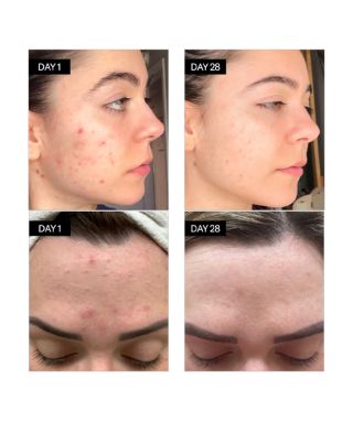 Sérum anti-imperfections Bl + C - 5ml