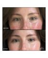 Revitalize Hydra Concealer WN04 RMS Beauty Résultats