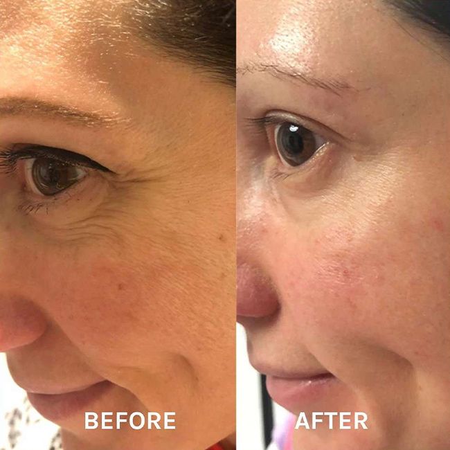 Sérum anti-age liftant Evolve Beauty