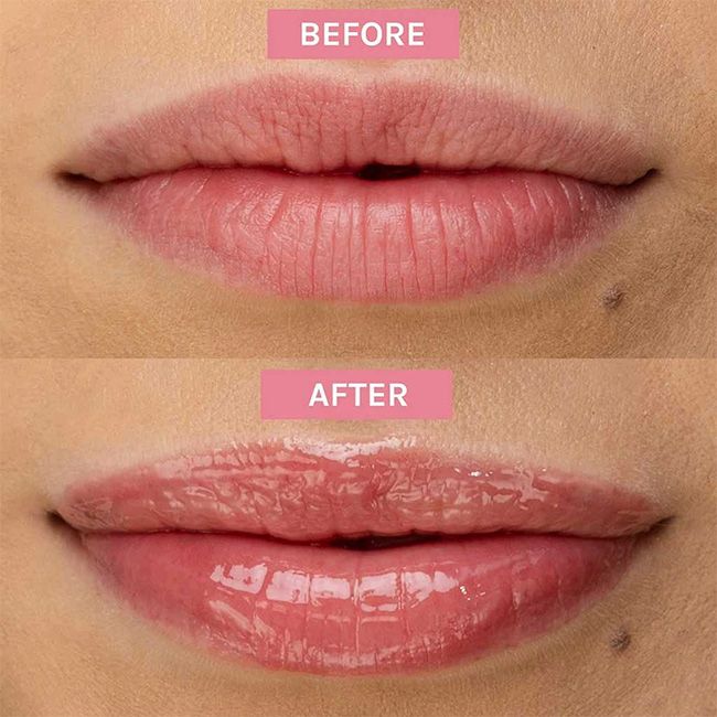 Gloss bio huile Retinol glossy Evolve Beauty