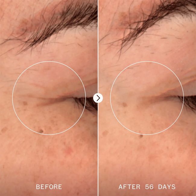 Sérum anti âge Nad+ 3 peptides renewal